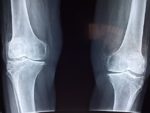 Read more about the article Knee Pain Relief…I Certainly Hope So